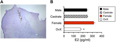 Sex Differences in Estradiol Secretion by Trigeminal Brainstem Neurons